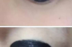 做眼线后多久可以吃辣的东西,辣食恢复期指南